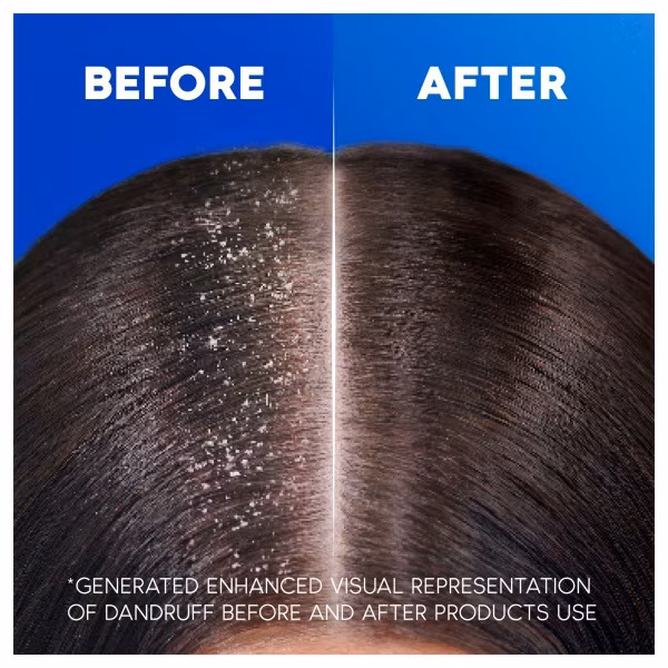 Head and Shoulders Supreme Moisture Shampoo 250ml