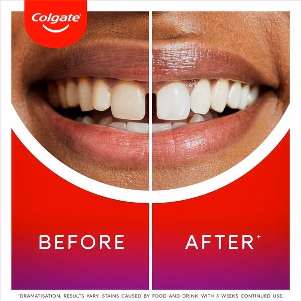 Colgate Max White Ultimate Whitening Toothpaste 75ml